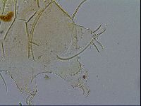 Echiniscus testudo image
