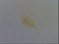 Echiniscus testudo image