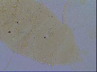 Echiniscus testudo image