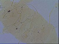Echiniscus testudo image
