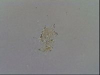 Echiniscus testudo image