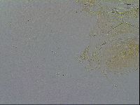 Echiniscus testudo image