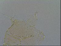 Echiniscus testudo image