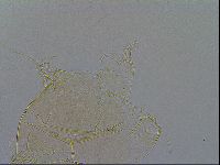 Media resource of Echiniscus testudo