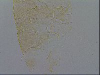 Echiniscus testudo image
