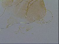 Echiniscus testudo image