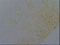 Echiniscus testudo image