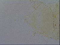 Echiniscus testudo image