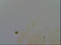 Echiniscus testudo image