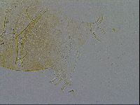 Echiniscus testudo image