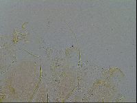 Echiniscus testudo image