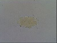 Echiniscus testudo image