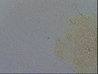 Echiniscus testudo image