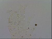 Echiniscus testudo image