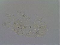 Echiniscus testudo image