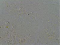Echiniscus testudo image