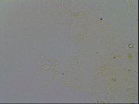 Echiniscus testudo image