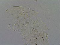 Echiniscus testudo image