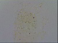 Echiniscus testudo image