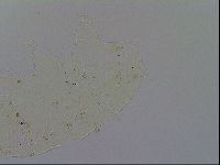 Echiniscus testudo image