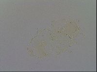 Echiniscus testudo image
