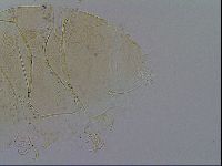 Echiniscus testudo image