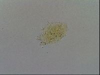 Echiniscus testudo image