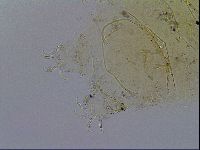 Echiniscus testudo image