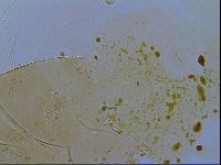 Echiniscus testudo image