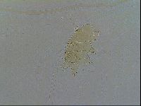 Echiniscus testudo image