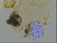 Echiniscus testudo image