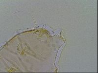 Echiniscus testudo image