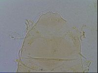 Echiniscus testudo image
