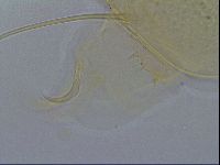 Echiniscus testudo image