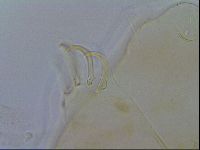 Echiniscus testudo image
