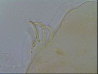 Echiniscus testudo image