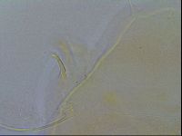 Echiniscus testudo image