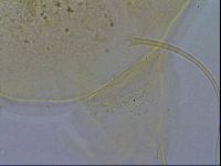 Echiniscus testudo image