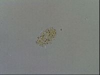 Echiniscus testudo image