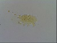 Echiniscus testudo image