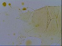Echiniscus testudo image