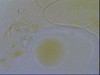 Echiniscus testudo image