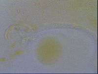 Echiniscus testudo image