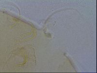 Echiniscus testudo image