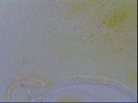Echiniscus testudo image