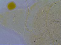Echiniscus testudo image