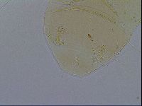 Echiniscus testudo image