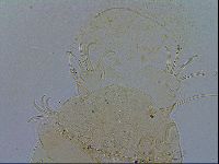 Echiniscus testudo image