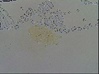 Echiniscus testudo image
