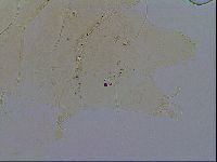 Echiniscus testudo image